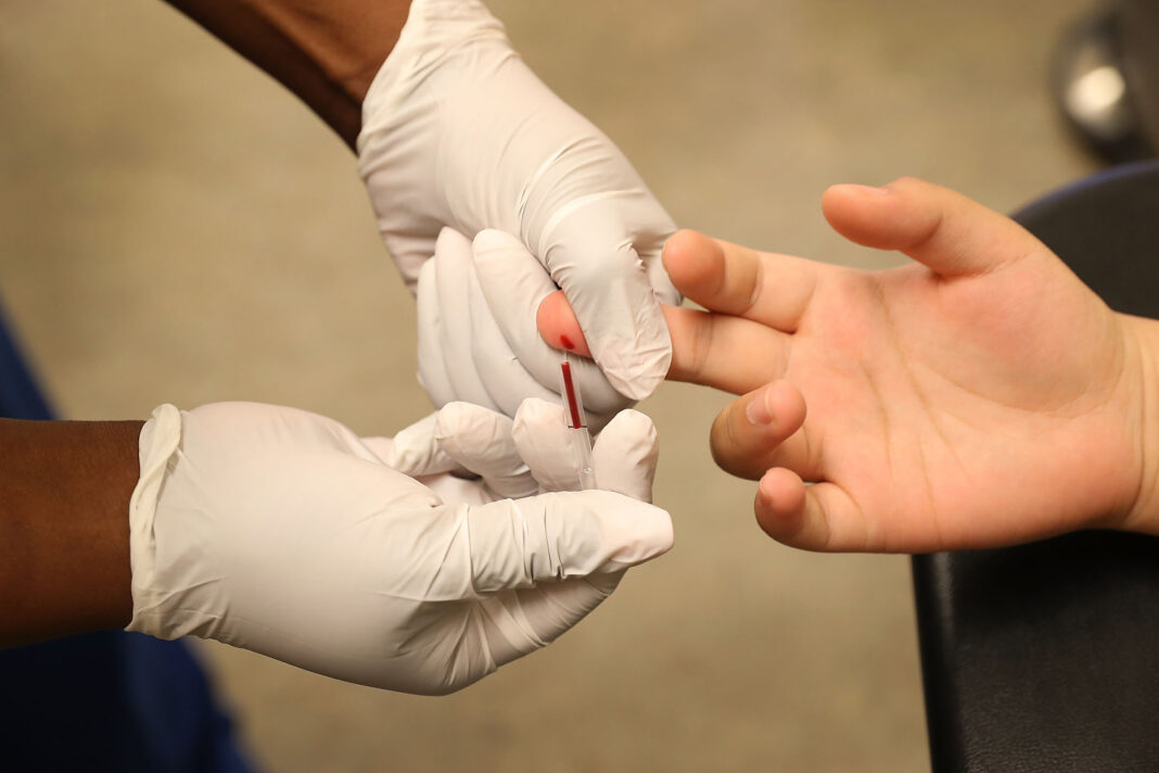 FDA approves powerful HIV drug with the potential to end the epidemic in the U.S.